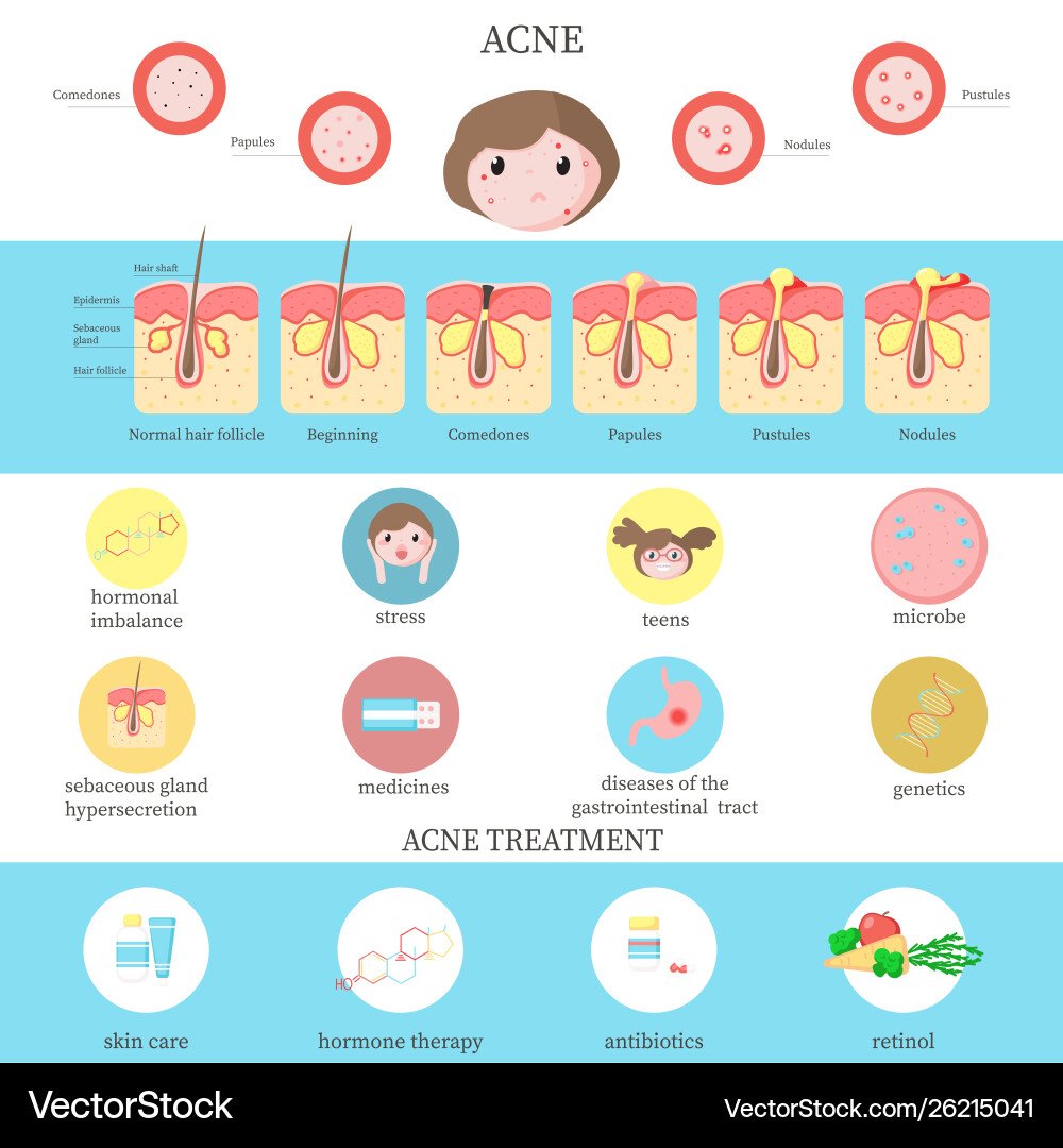 How to Identify Your Acne Type